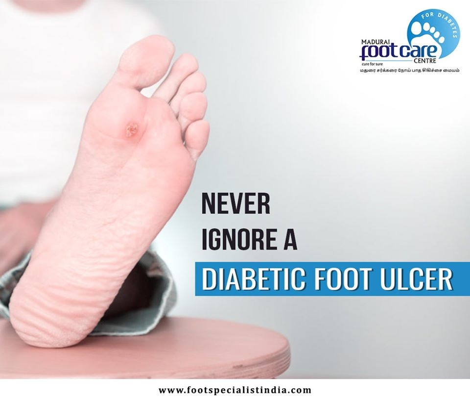 How to Spot and Treat Common Diabetic Foot Ulcer Symptoms